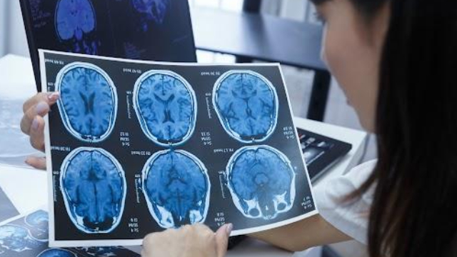 médica neurologista analisando uma tomografia cerebral