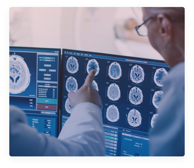 equipe médica analisando exames neurológicos