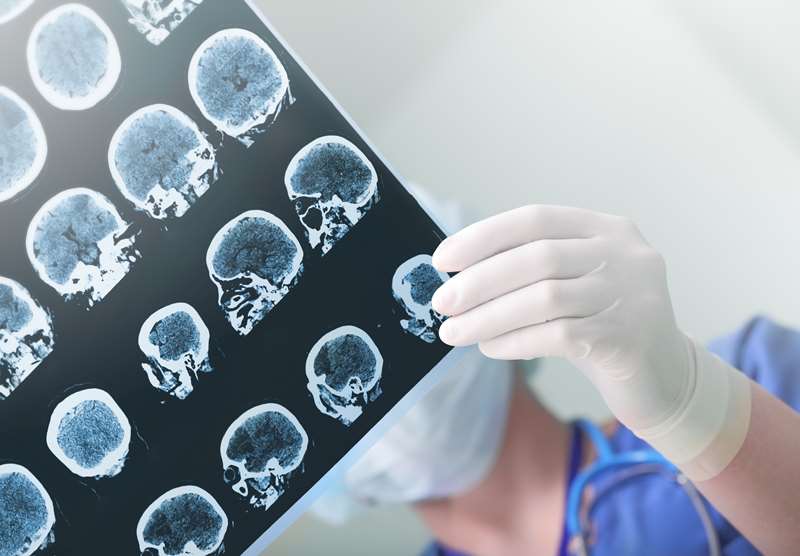 Cirurgião segurando resultado de exame neurológico