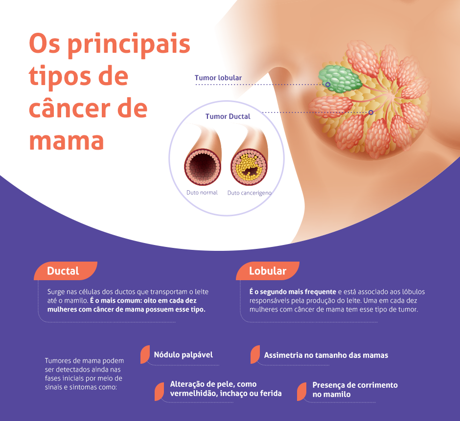 Folder explicativo sobre os principais tipos de câncer de mama (ductal e lobular)