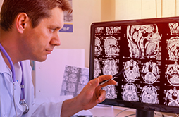 Médico neurologista avaliando exames na tela de um computador