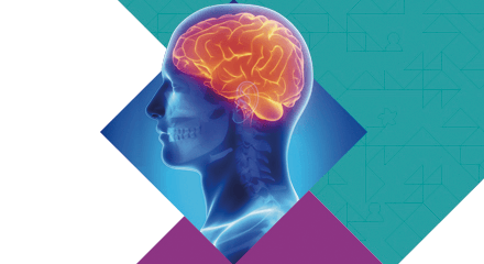Avanço nos métodos de Imagem em Neurorradiologia